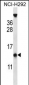 PYDC1 Antibody (Center)